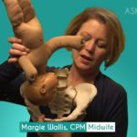 Margie Wallis- Pregnancy Baby Dropped
